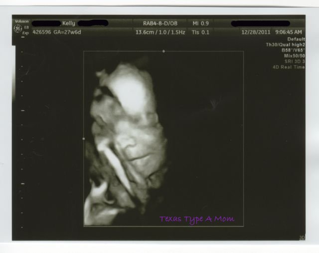 girl ultrasound 28 weeks