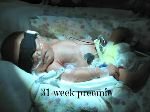 31 Week Preemie Picture